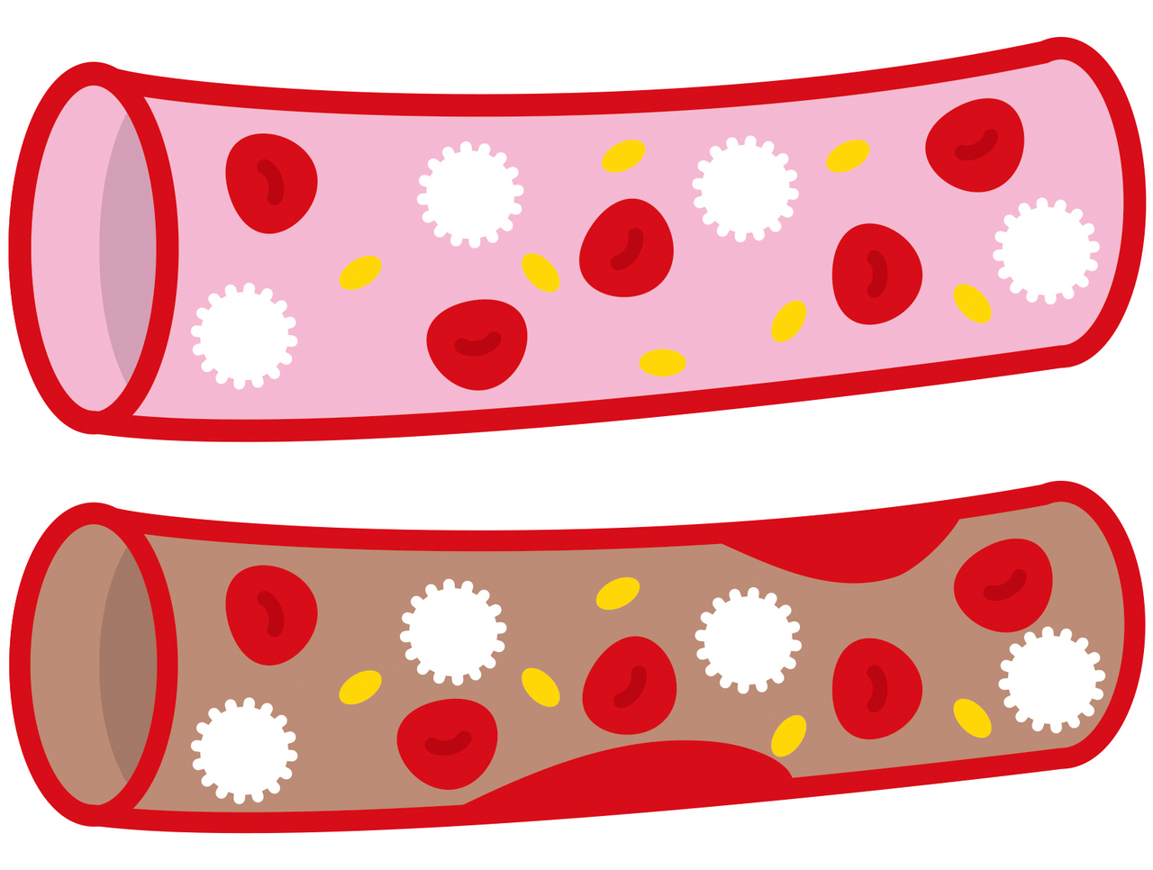 長時間の同じ姿勢による血行不良やリンパの滞りで、足の重だるさや痺れ、こむら返りが起こる